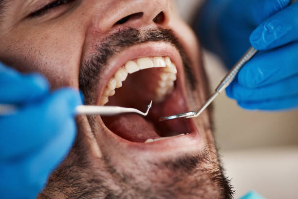 Best Cracked Tooth Emergency Dentist  in Dillon, MT