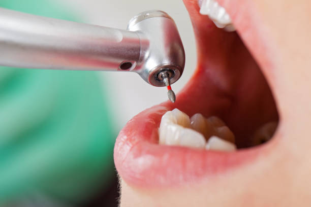 Emergency Gum Pain Relief in MT